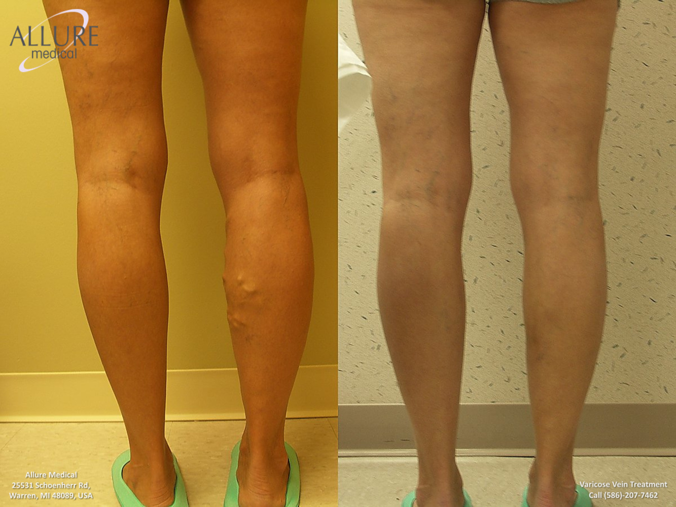 Allure Medical in Warren